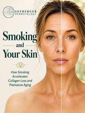 SmokingAndSkin300